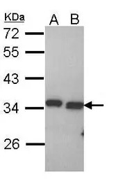 PECR antibody [C2C3], C-term