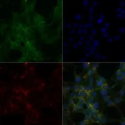 Sodium/Potassium ATPase alpha 