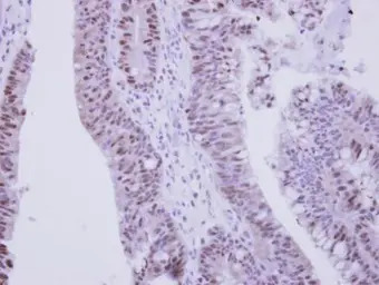 ZNF329 antibody
