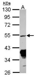 Rxraa+b antibody