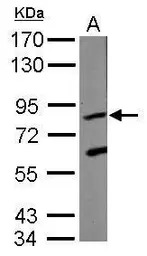 KRIT1 antibody [C1C3]