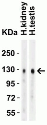 ACE2 antibody