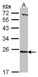 HEBP1 antibody [N1C3]