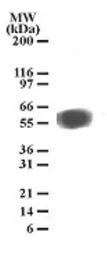 TEM7 antibody [197C193(IM193)]