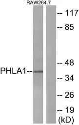 PHLDA1 antibody