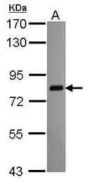CPSF73 antibody