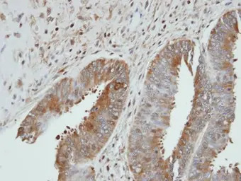 UGP2 antibody [N1C1]