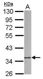 p41-ARCb antibody [N2C2], Inte