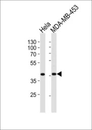 Calponin 1 antibody, N-term