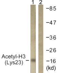 Histone H3K23ac (Acetyl Lys23)