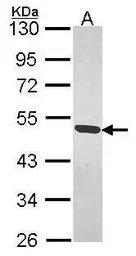 MAGEB1 antibody
