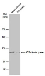 ATP citrate lyase antibody [N1