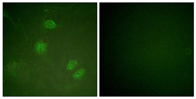 ELK3 antibody