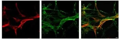 MLC1 antibody, Internal
