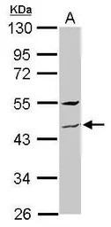 ZNF514 antibody [N1C1]