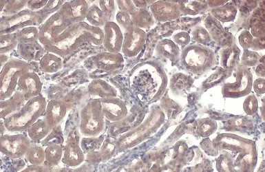 NFkB p65 antibody