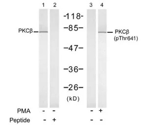 PKC beta 2 (phospho Thr641) an