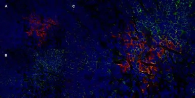 IL2 Receptor alpha antibody [O