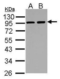 alpha Actinin 3 antibody