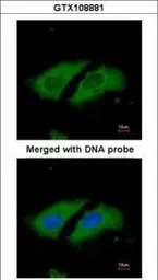 STK33 antibody [N1C3]
