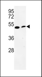PISD antibody, Internal