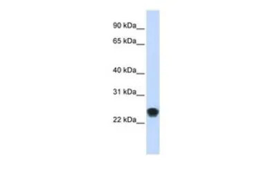 FKBP11 antibody, N-term