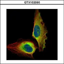NFkB p65 antibody