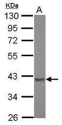 Aspartoacylase antibody