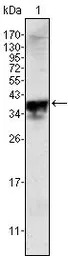 Androgen Receptor antibody [2H
