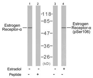 Estrogen Receptor alpha (phosp