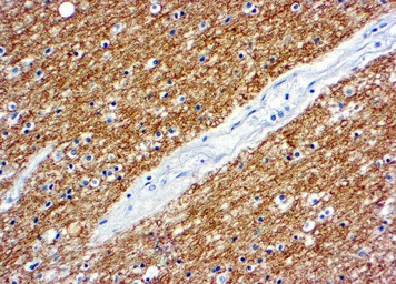 Myelin basic protein antibody