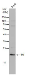 Bid antibody [N1C3-2]