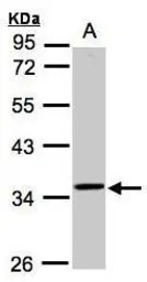 RG9MTD3 antibody [N2C3]