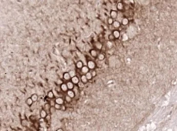 5-HT2A receptor antibody