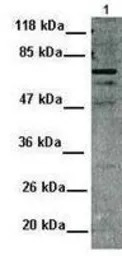 MDMX antibody, N-term