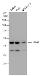 DOK2 antibody [N1C1]