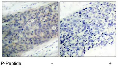 LIM kinase 2 (phospho Thr505) 
