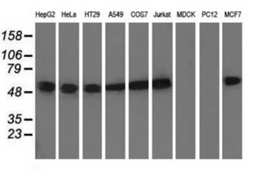alpha Tubulin 8 antibody [2C2]