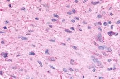 5-HT5A receptor antibody