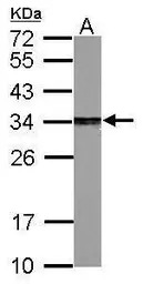 PSME3 antibody