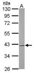 SAE1 antibody