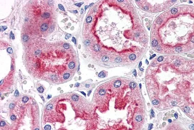 SMAD9 antibody, Internal