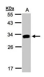 GILT antibody