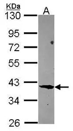 FBLIM1 antibody [N3C3]