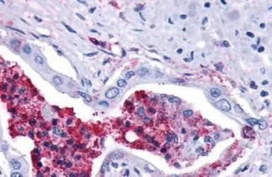 Leukotriene B4 Receptor 2 anti