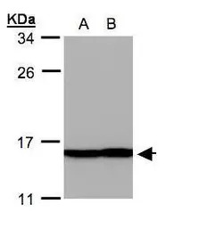 Profilin 2 antibody