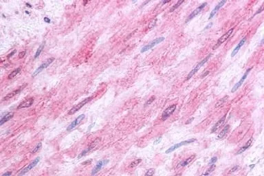 5-HT1B receptor antibody