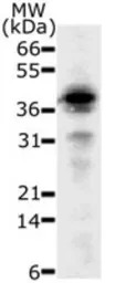 DFFB antibody [36A349]