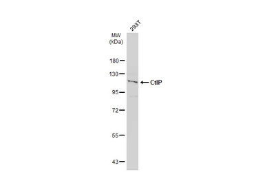 CtIP antibody [C1C3]
