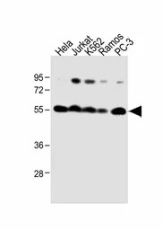 Calreticulin antibody, Interna